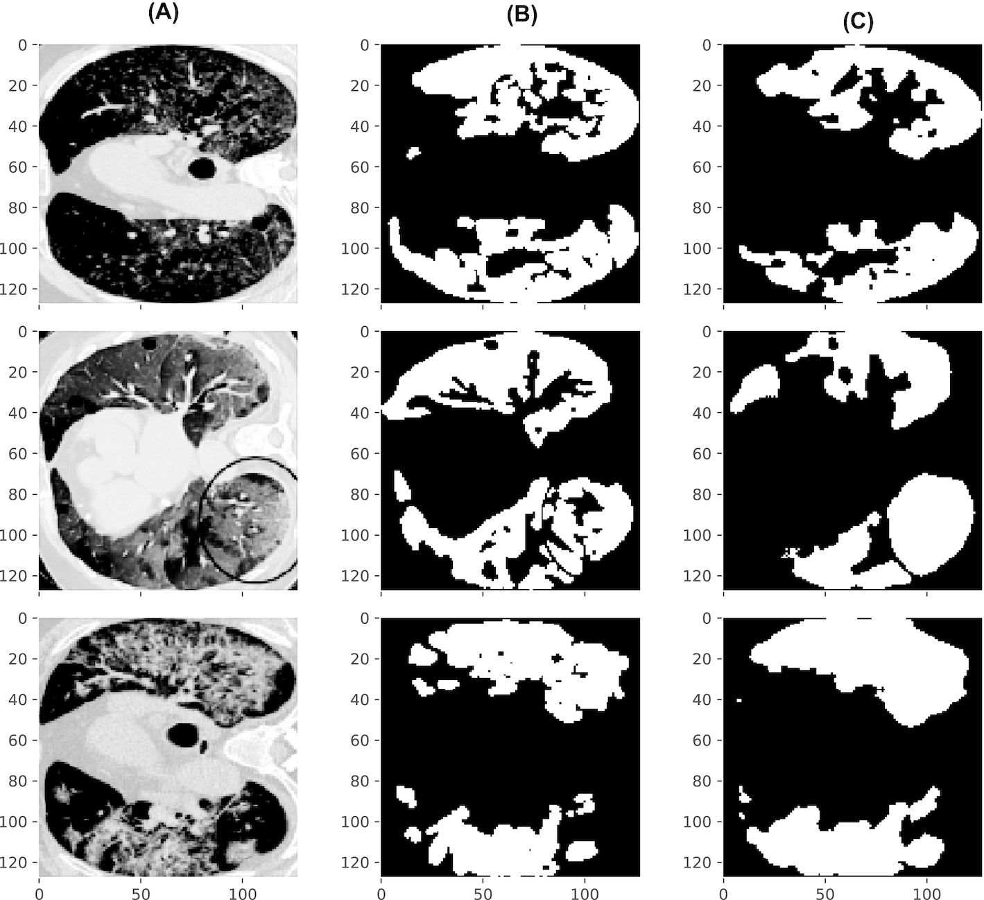 ML-generated CT masks