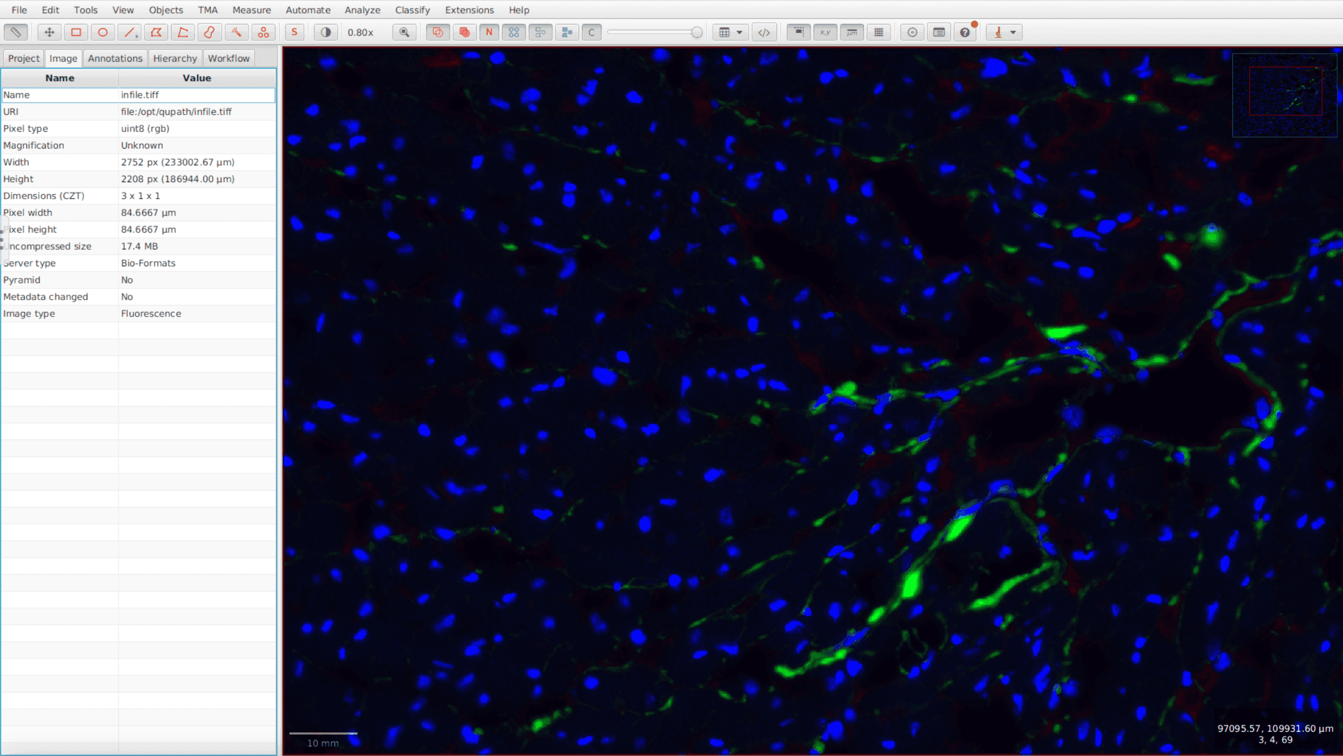 Fluorescence image of cardiac tissue